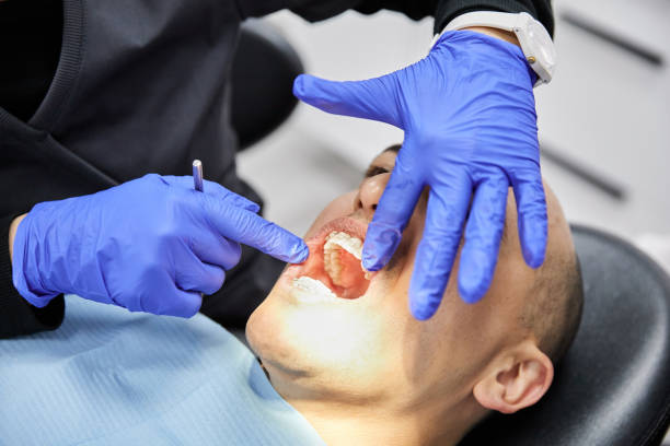 Best Knocked-Out Tooth (Avulsed Tooth) Treatment in Simmesport, LA