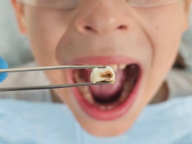 Best Weekend Emergency Dental Services in Simmesport, LA